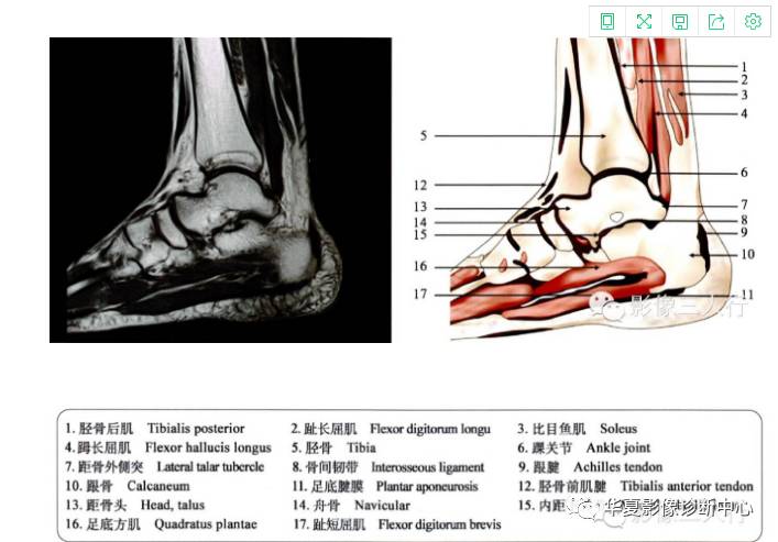 精美图片:"踝和足"的断层解剖图谱