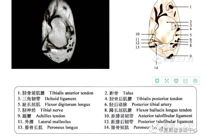 精美图片:"踝和足"的断层解剖图谱