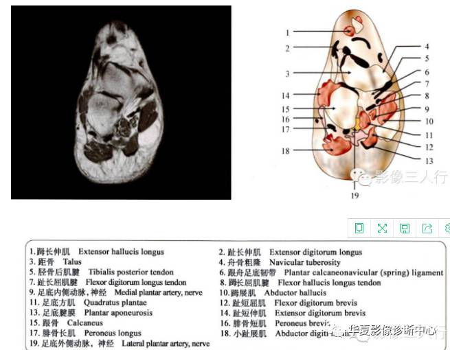 精美图片:"踝和足"的断层解剖图谱