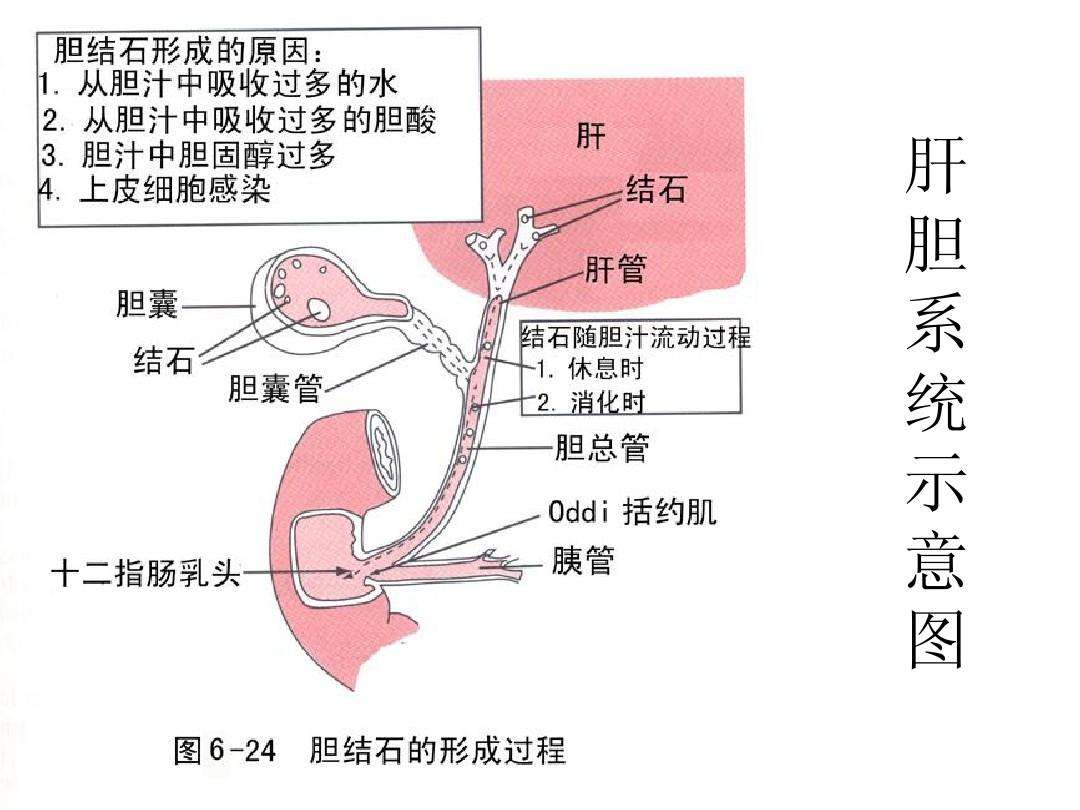 如何从日常饮食中预防胆结石?