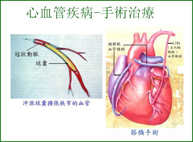 喝啤酒肩膀酸痛怎么办