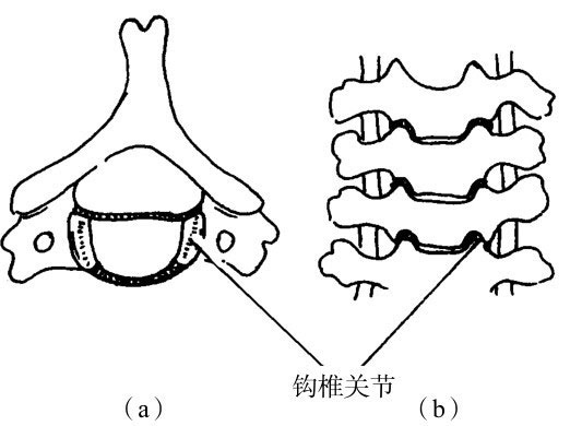 三种方式:第一 ,椎间盘,即追歼纤维软骨盘,是椎体之间的主要连接方式