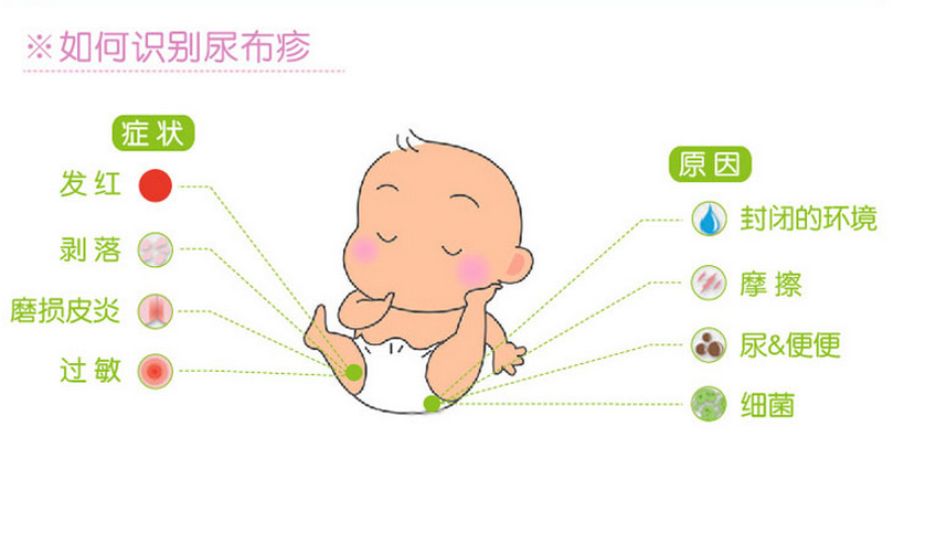 中医预防宝宝尿布疹5大最有效疗法