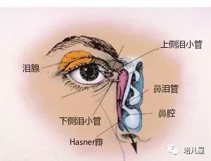 在小婴儿中, 先天性鼻泪管阻塞最为常见.