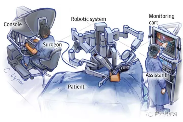 顶尖期刊《jama》:直肠癌根治术手术方式选择:达芬奇机器人还是腹腔镜
