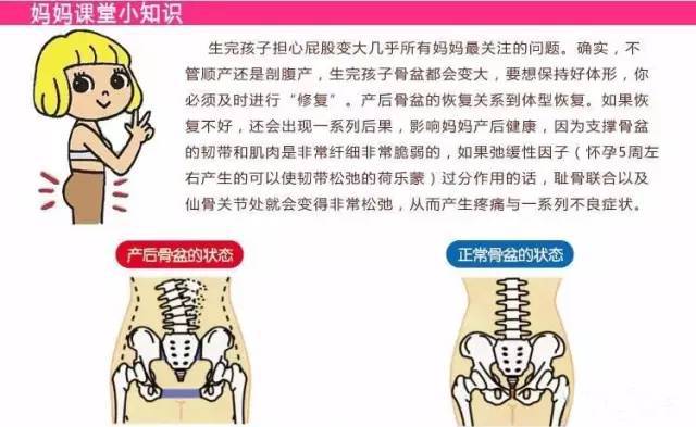 怀孕和生孕是引起女性盆骨变形的主要原因