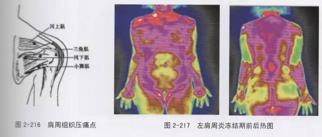 趣味红外 第二期——人体红外