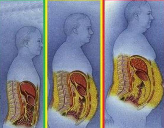 腹部脂肪过多   阻碍身体正常的血循环   易增加心脏负担   增加
