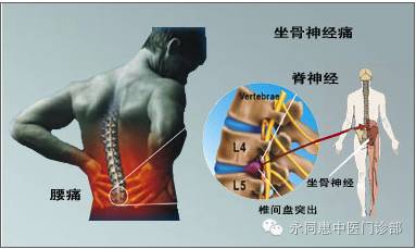 中医治疗腰椎病的原理是什么_幸福是什么图片