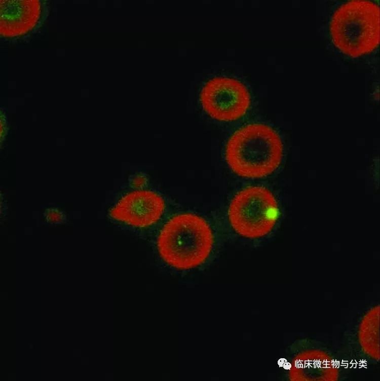 注:瑞氏染色, 图片来自pubmed