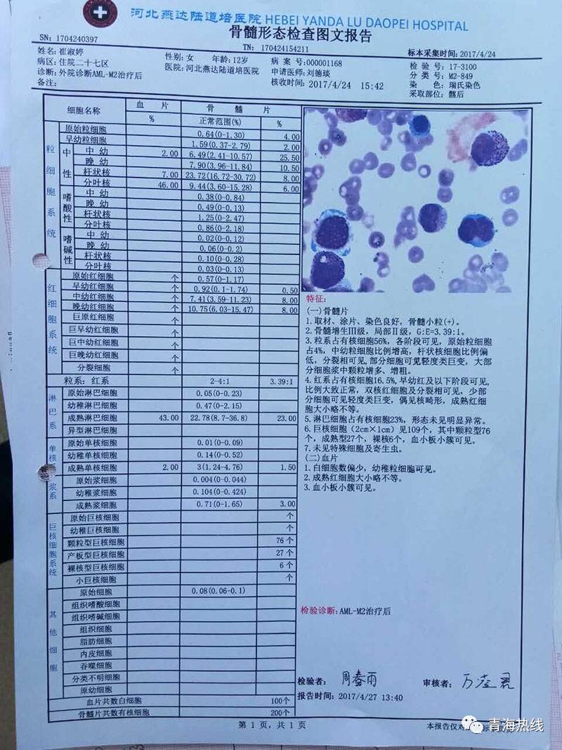 我们的宝贝女儿崔淑婷被医院确诊为"急性髓系白血病!