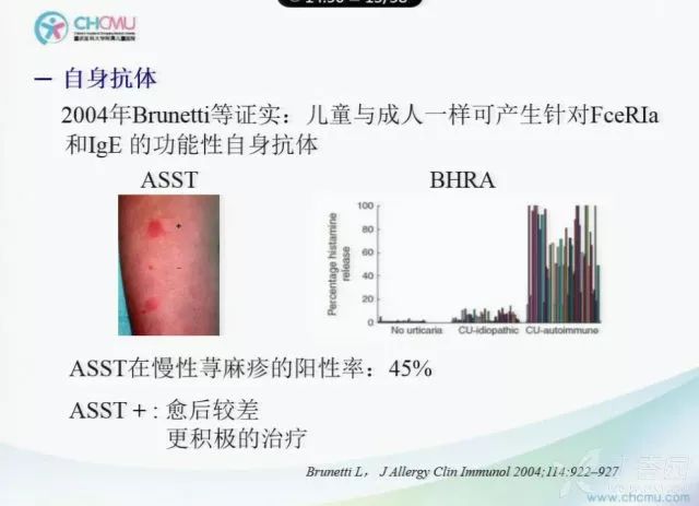 22界儿科大会听课 ppt:儿童肺炎支原体肺炎诊治要点3.