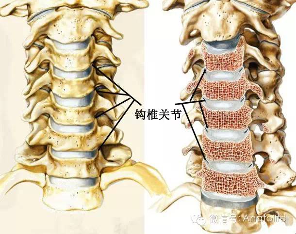 a:颈椎上面观;b:颈椎侧面观颈椎椎骨共有七个,好发颈椎病的椎体一般在