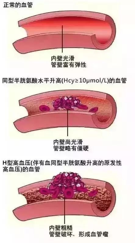 人口生理密度_中国人口密度图(3)