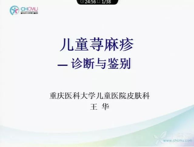 22界儿科大会听课 ppt:儿童肺炎支原体肺炎诊治要点3.