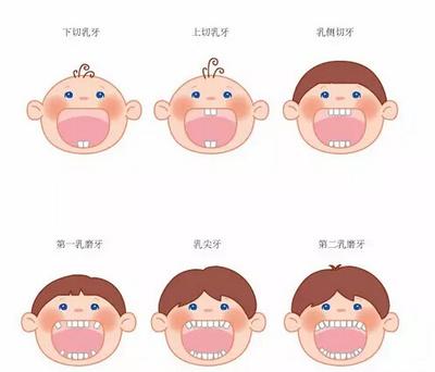 儿童期龋齿不可忽视,小心影响恒牙正常萌出