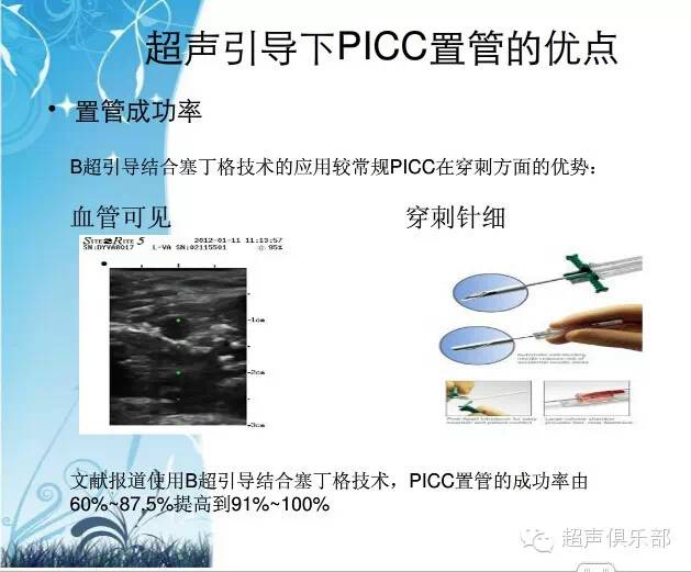 超声引导下picc置管术临床应用及操作视频