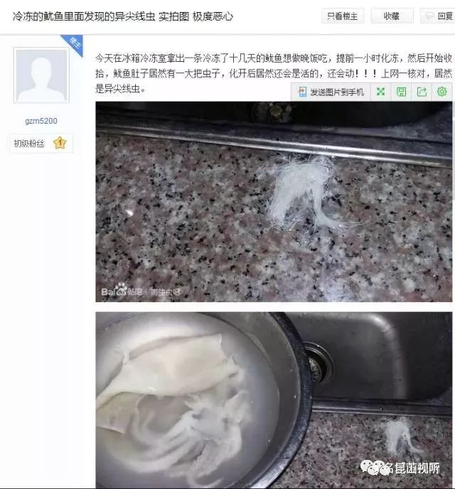 目前尚无特效驱异尖线虫药物治疗 故事是从一条冷冻了十几天的鱿鱼