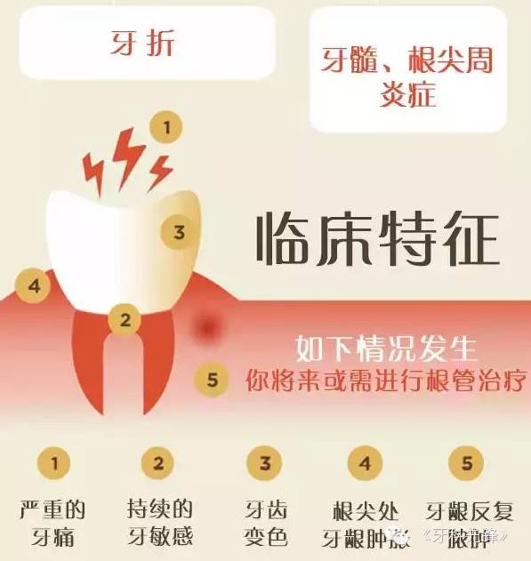 图解根管治疗专治牙齿内心疾病