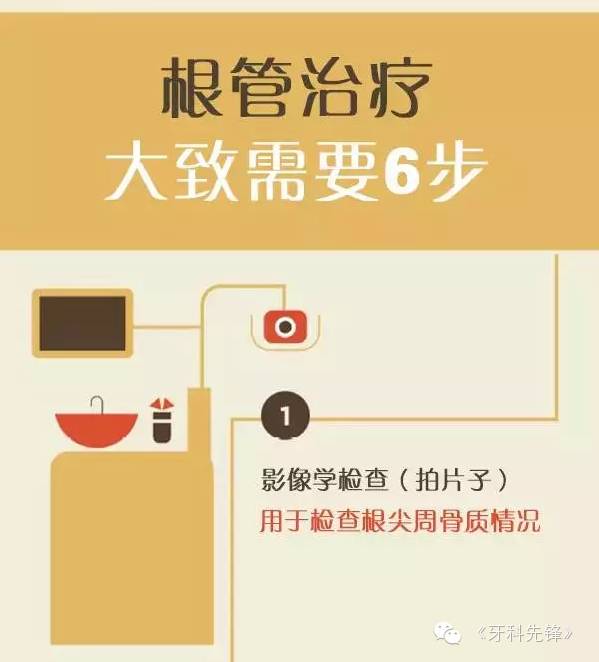 图解根管治疗专治牙齿内心疾病