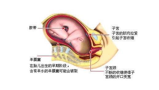 如果开宫口不顺,在活跃期时需要及早决定,或借助药物,或进行剖宫产