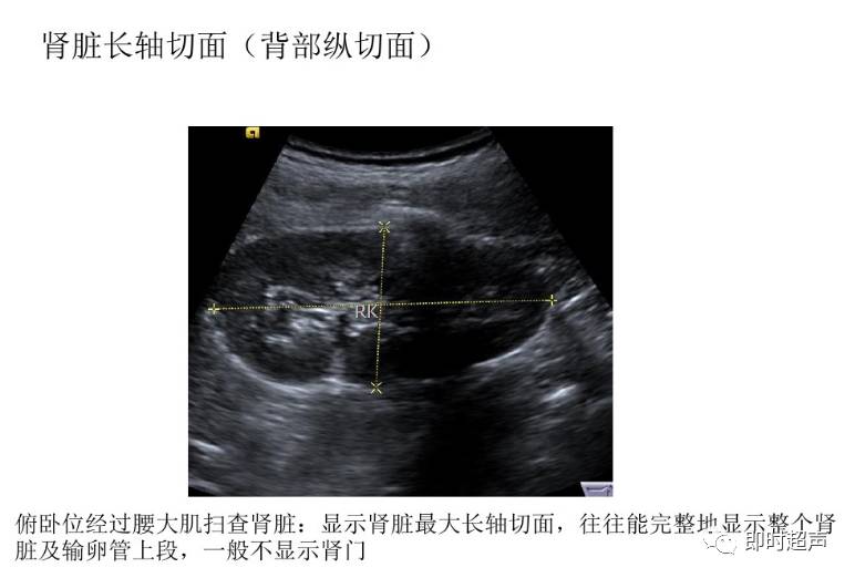 腹部超声检查常用切面