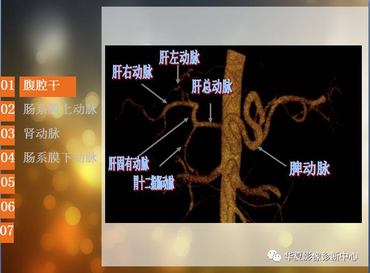 最全的腹部血管解剖图谱伴cta图赶紧收藏了一