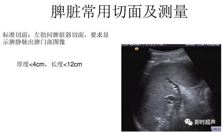 腹部超声检查常用切面