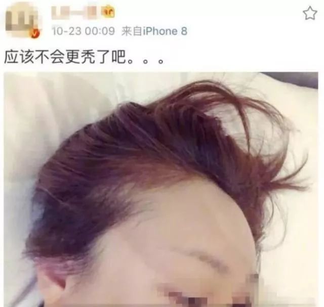 秃顶女生是什么命格？