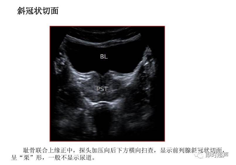 腹部超声检查常用切面