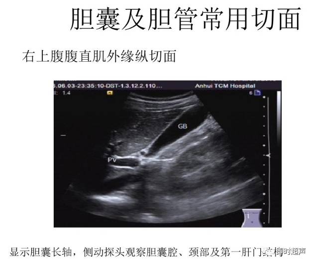 腹部超声检查常用切面