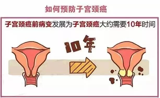 揪出女性健康"第一杀手-宫颈癌,或许他可以帮到您