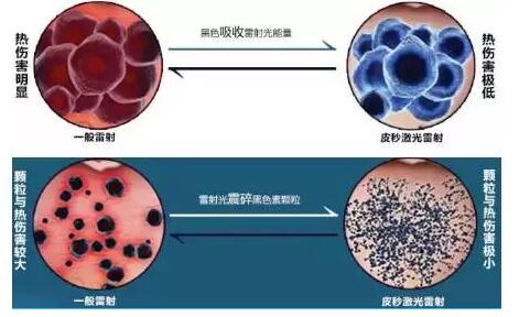 皮秒激光的原理和作用_皮秒激光切割玻璃的原理和工艺研究(2)