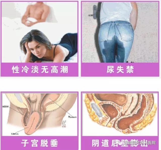 什么是盆底功能障碍性疾病?