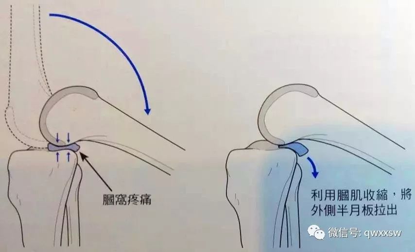 精进专题肌肉篇腘肌