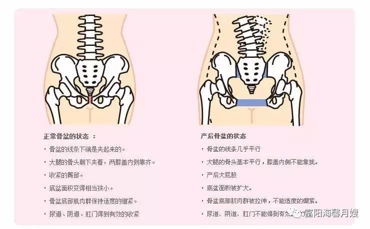 如果骨盆出现变形,这些骨骼也会随之产生畸变而妨碍其发挥正常作用