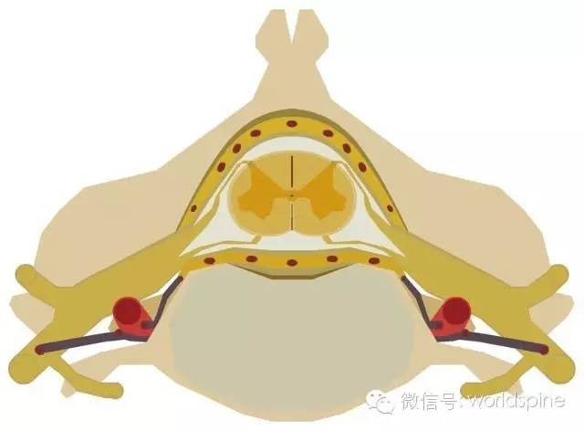 四 脊髓横断综合症脊髓发生急性横断损伤时,病灶节段水平以下呈现