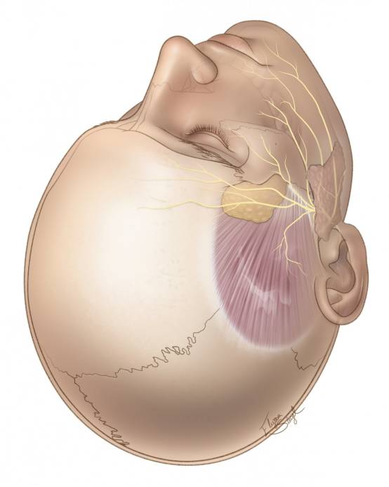 眶上开颅术手术策略与技巧丨the neurosurgical atlas系列