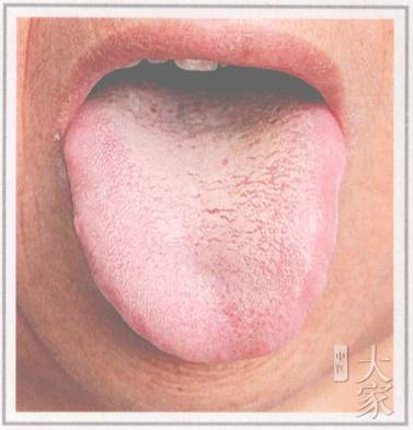 舌诊丨4种舌苔辨清宝宝感冒寒热