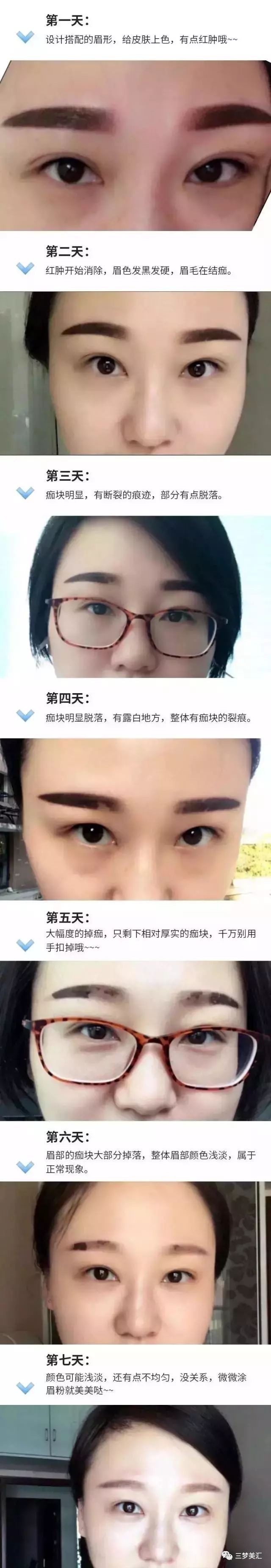 美丽蜕变,纹绣结痂掉痂全过程!