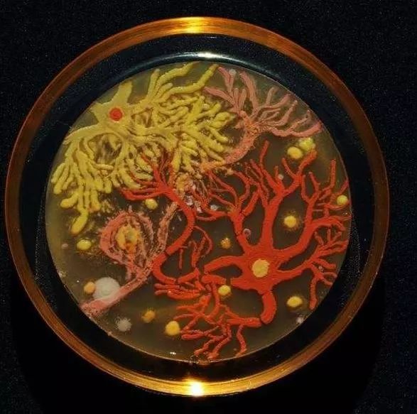 于是,美国微生物学会(asm)就举办了「艺术大赛」(asm agar art