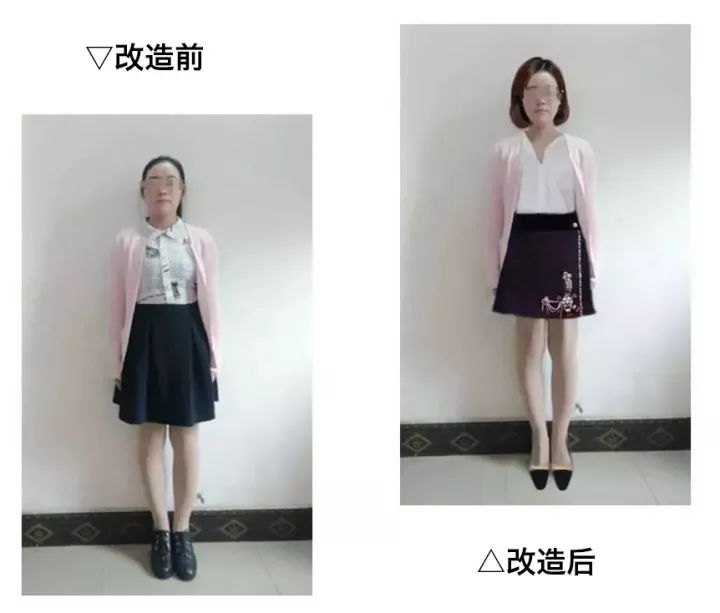 土气女孩怎么穿搭_土气穿搭的照片