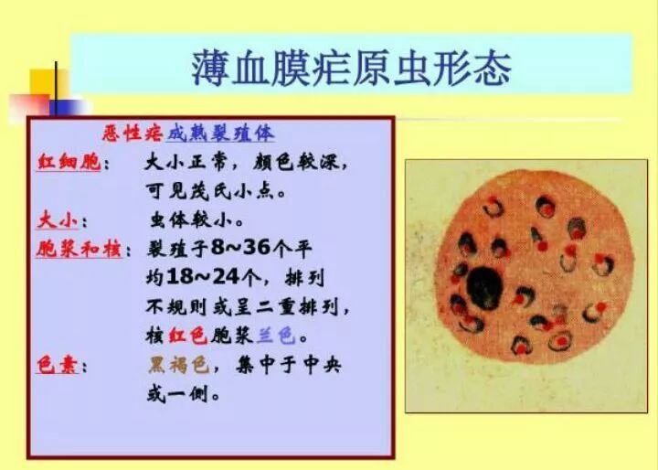 尿液管型图片分享细胞图片分享疟原虫专辑