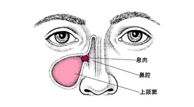 鼻子堵的原理_茜施妃雅小知识 鼻子毛孔堵塞怎么办 鼻子毛孔堵塞原因处理方法