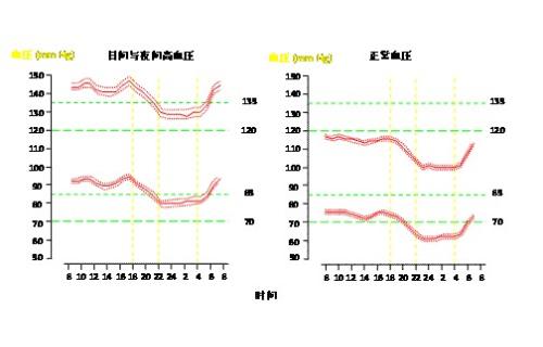 动态血压的国内正常参考标准:24小时平均值 130/80mmhg,白昼平均 135