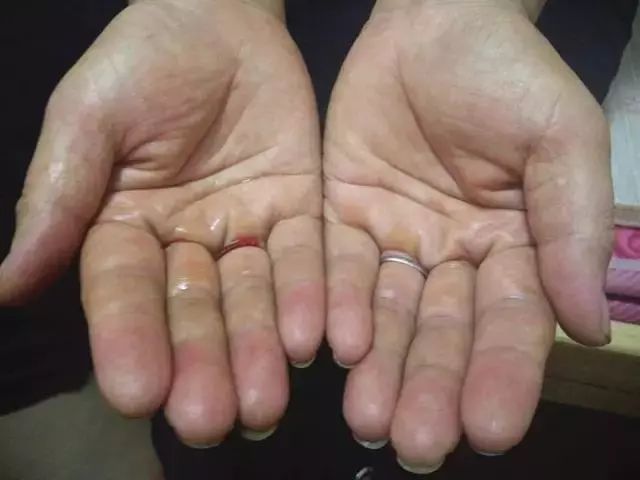 在丰县,他们的手没有一天是干净的!