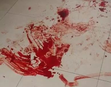 浙江10岁男童被亲生父亲砍成重伤,单是头部就被砍了29刀!