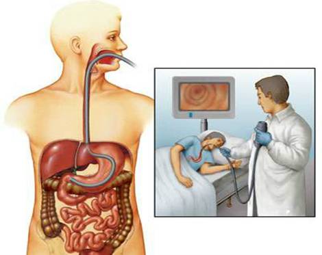 健康管理胃镜检查小常识