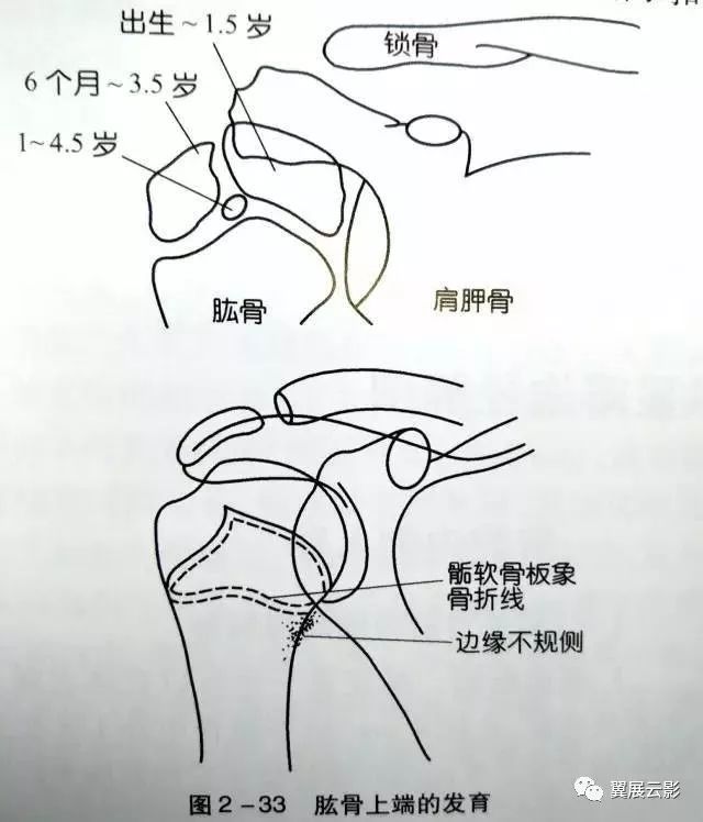 肱骨近端有3个骨骺骨化中心,即肱骨头,大结节及小结节骨化中心.