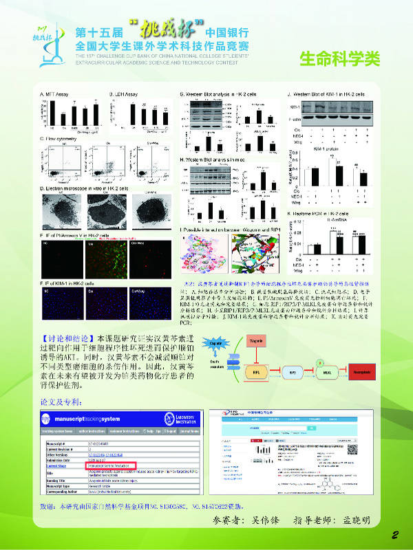 【科技学术节】挑战杯国赛来啦,我校冲入决赛作品是这个!